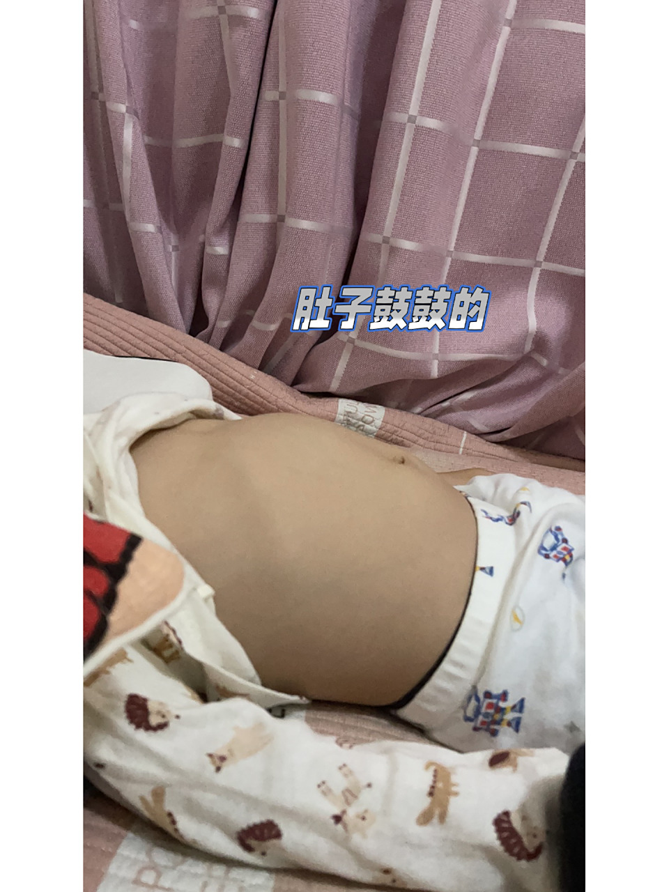 小孩子肚子鼓鼓的 圆圆的 是什么原因呢?