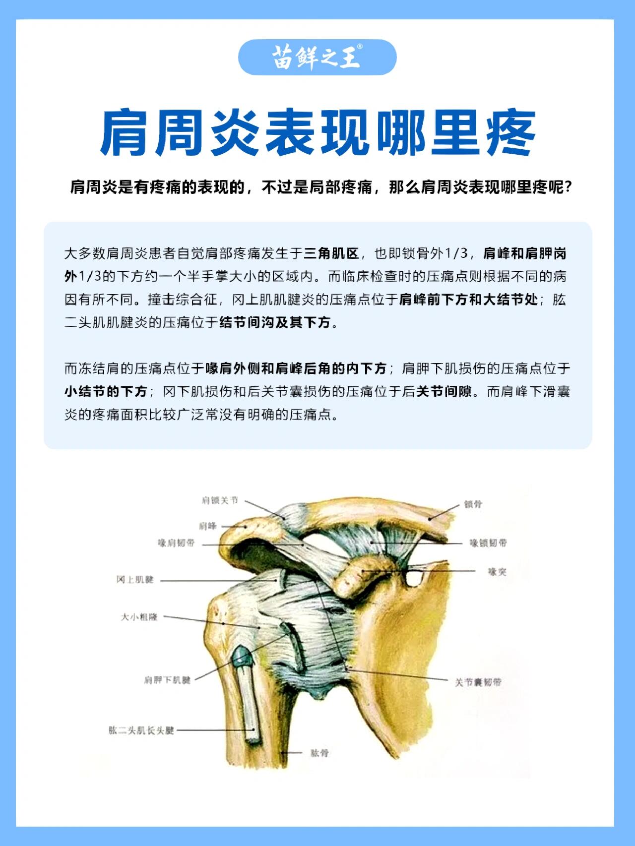 肩周图片位置示意图图片