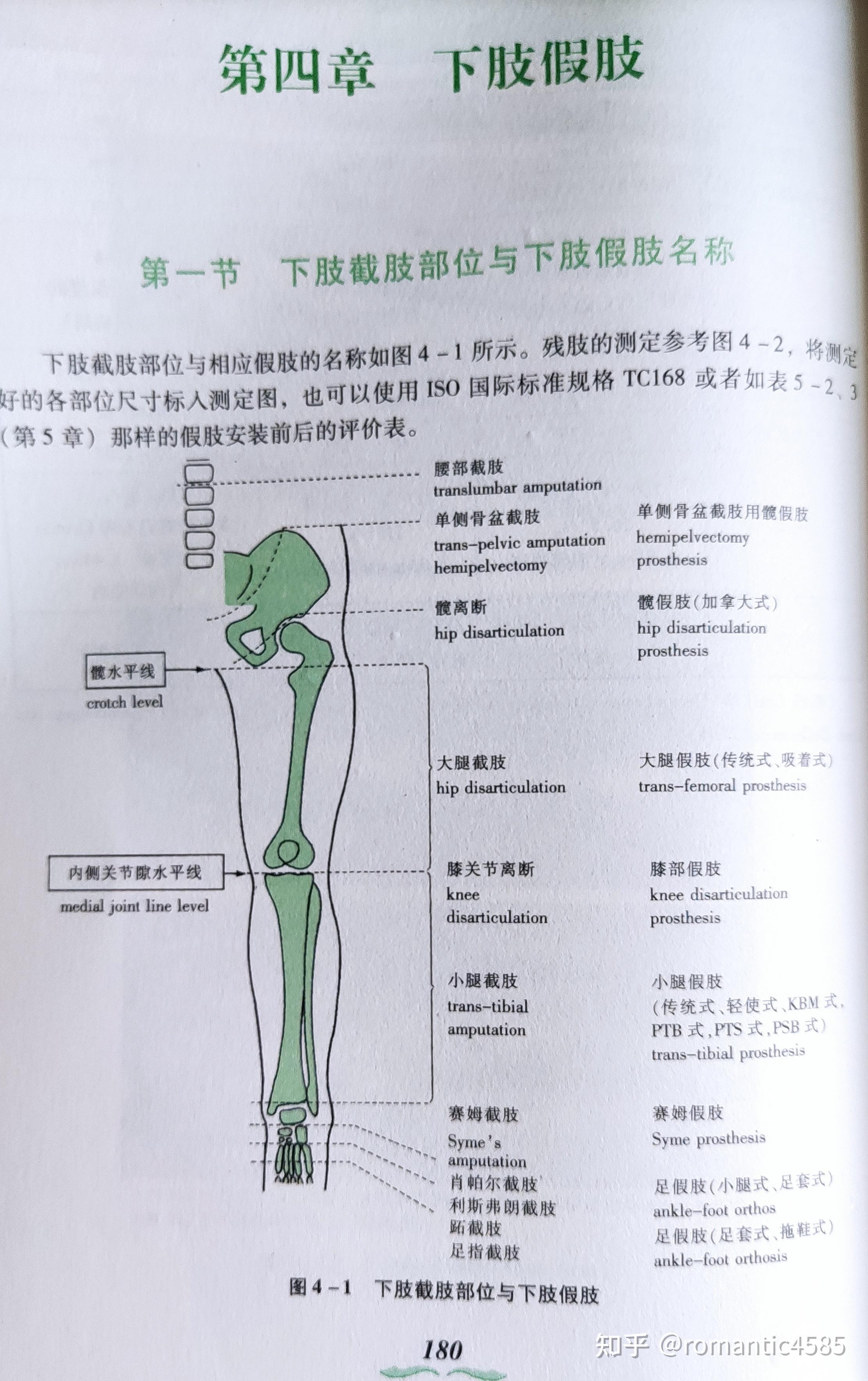 小儿髋关节x光片解读图片