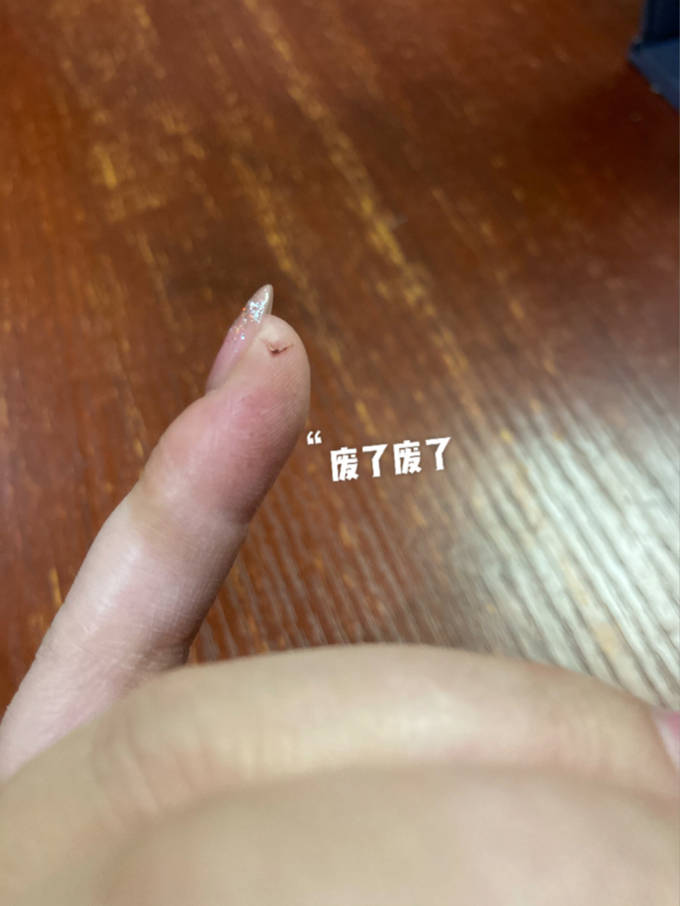 一个小伤口,没及时去打破伤风,现在好了又吃药又擦药