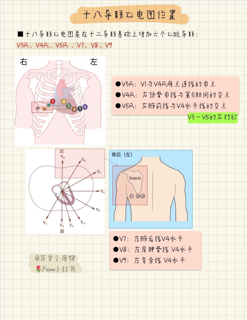 心电图导联位置图片女图片