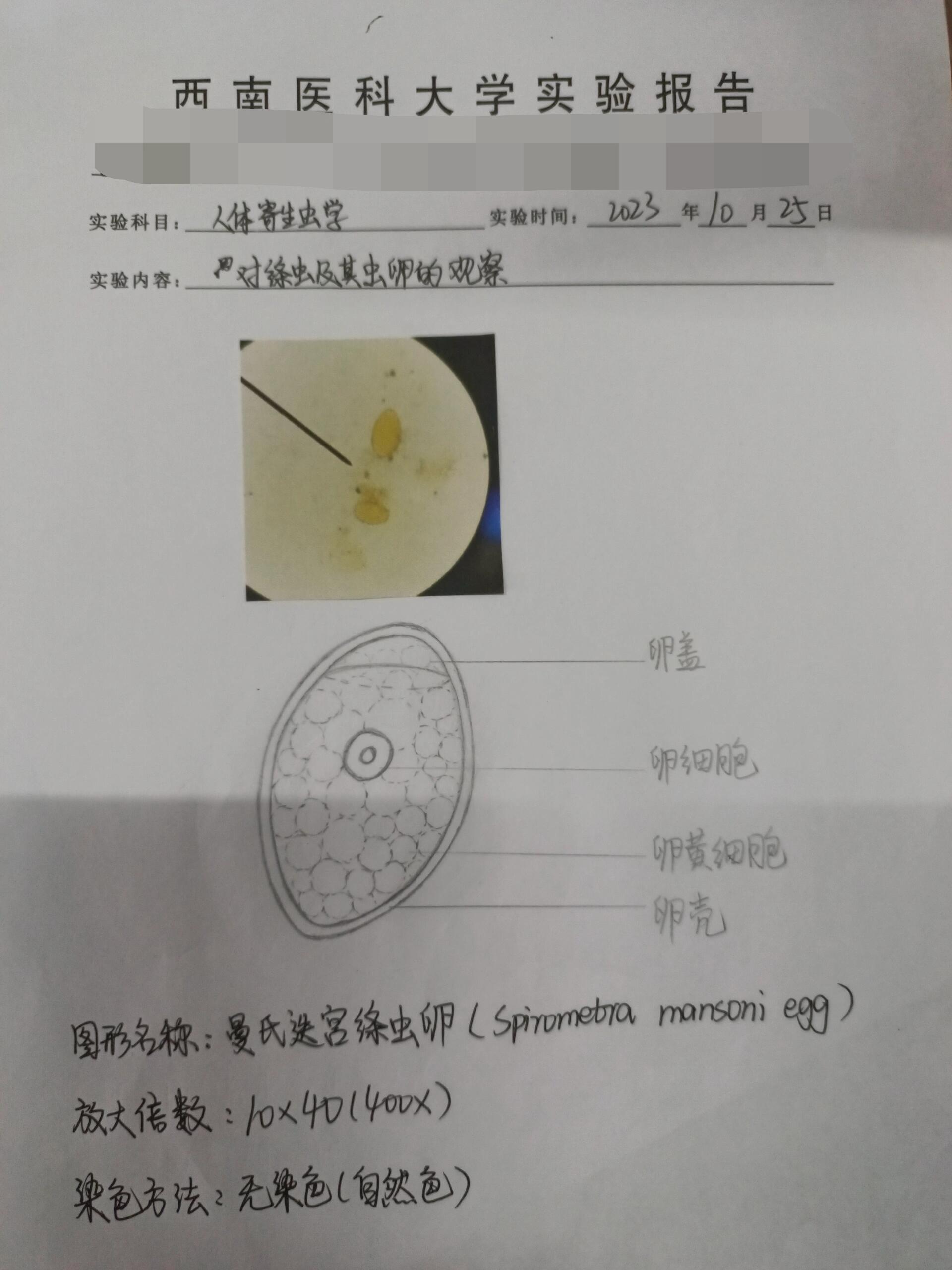 猪囊尾蚴虫卵图片