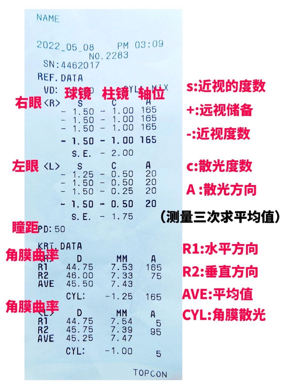 手把手教你学会看电脑验光单.