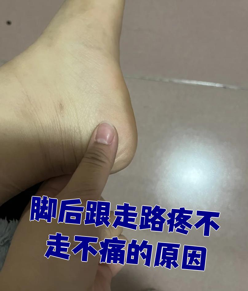 不走路就不痛,常见原因有跟骨骨刺,足底筋膜炎或脂肪垫炎
