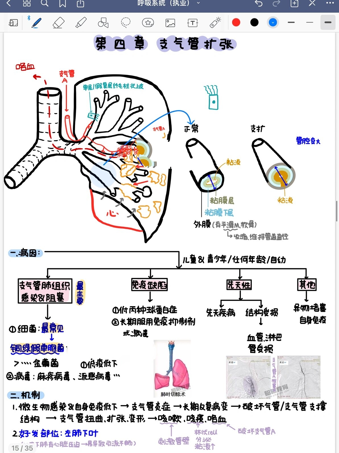 呼吸球囊结构图图片