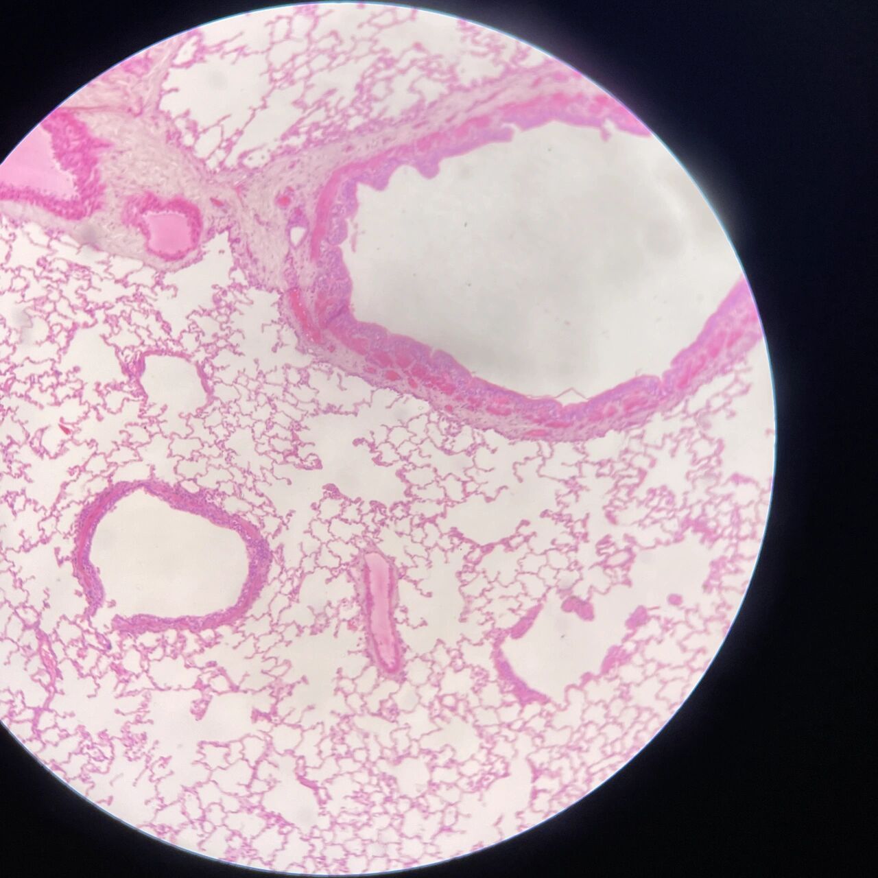 组胚绘图12-肺组织(呼吸部)