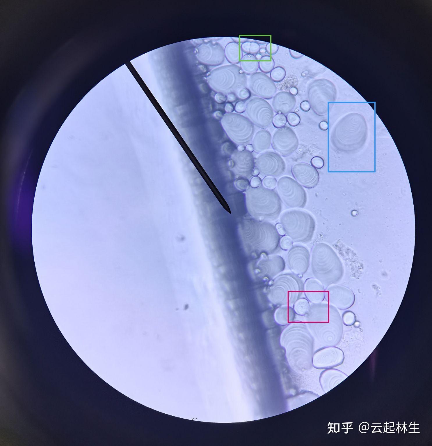 半夏淀粉粒显微镜图图片