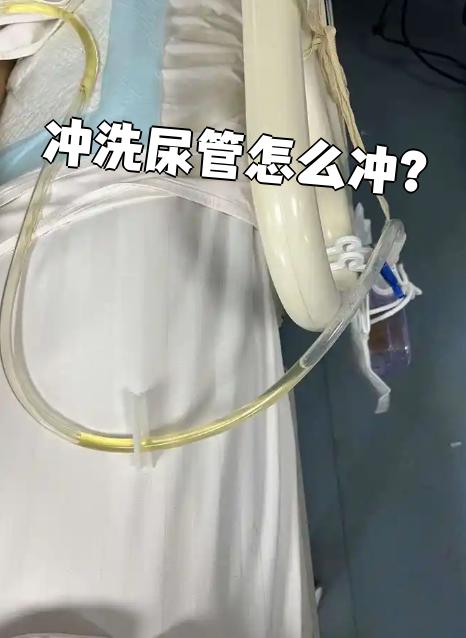 冲洗尿管怎么冲?