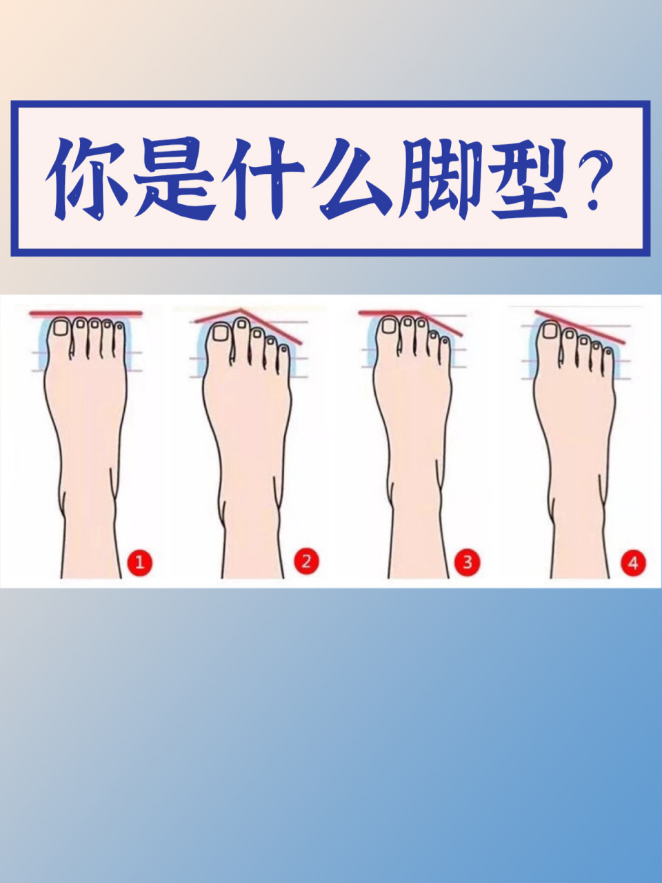 99脚型199 当所有脚趾的长度几乎