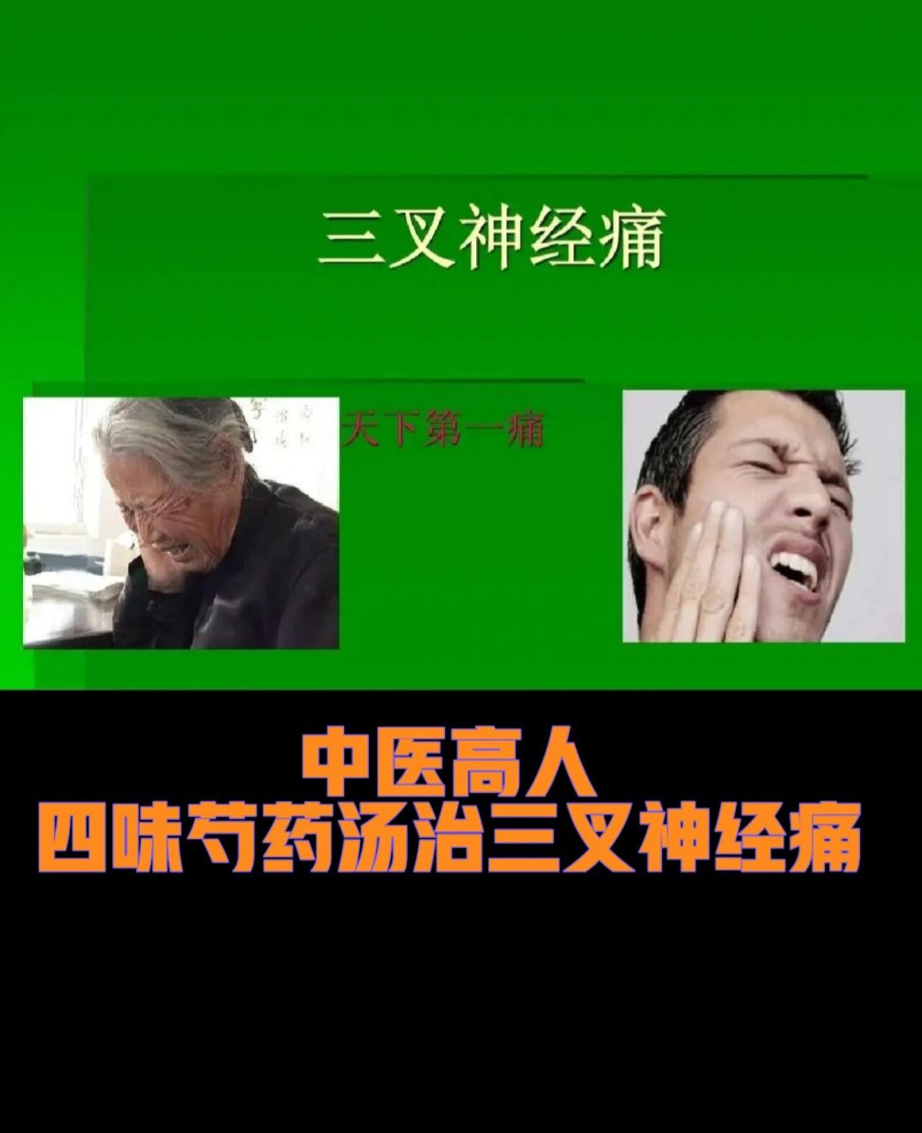 中医高人四味芍汤治三叉神经痛 中医高人夏度衡 四味芍药汤治三叉神经