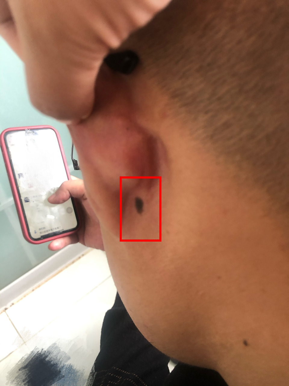 耳根痣相 大师们给看看,这个痣是不是不好,又黑又大