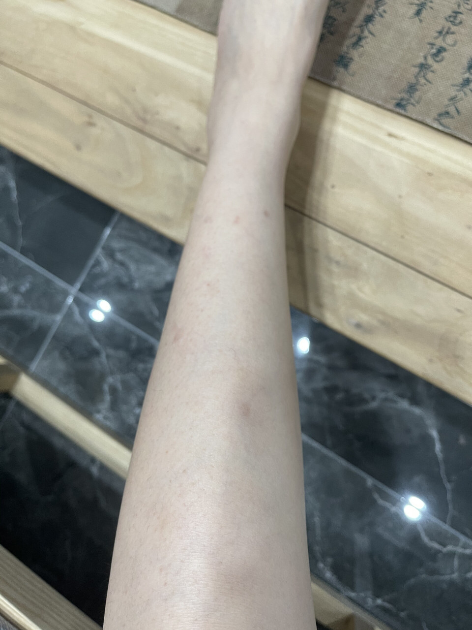 欣赏一下腿上的扁平疣