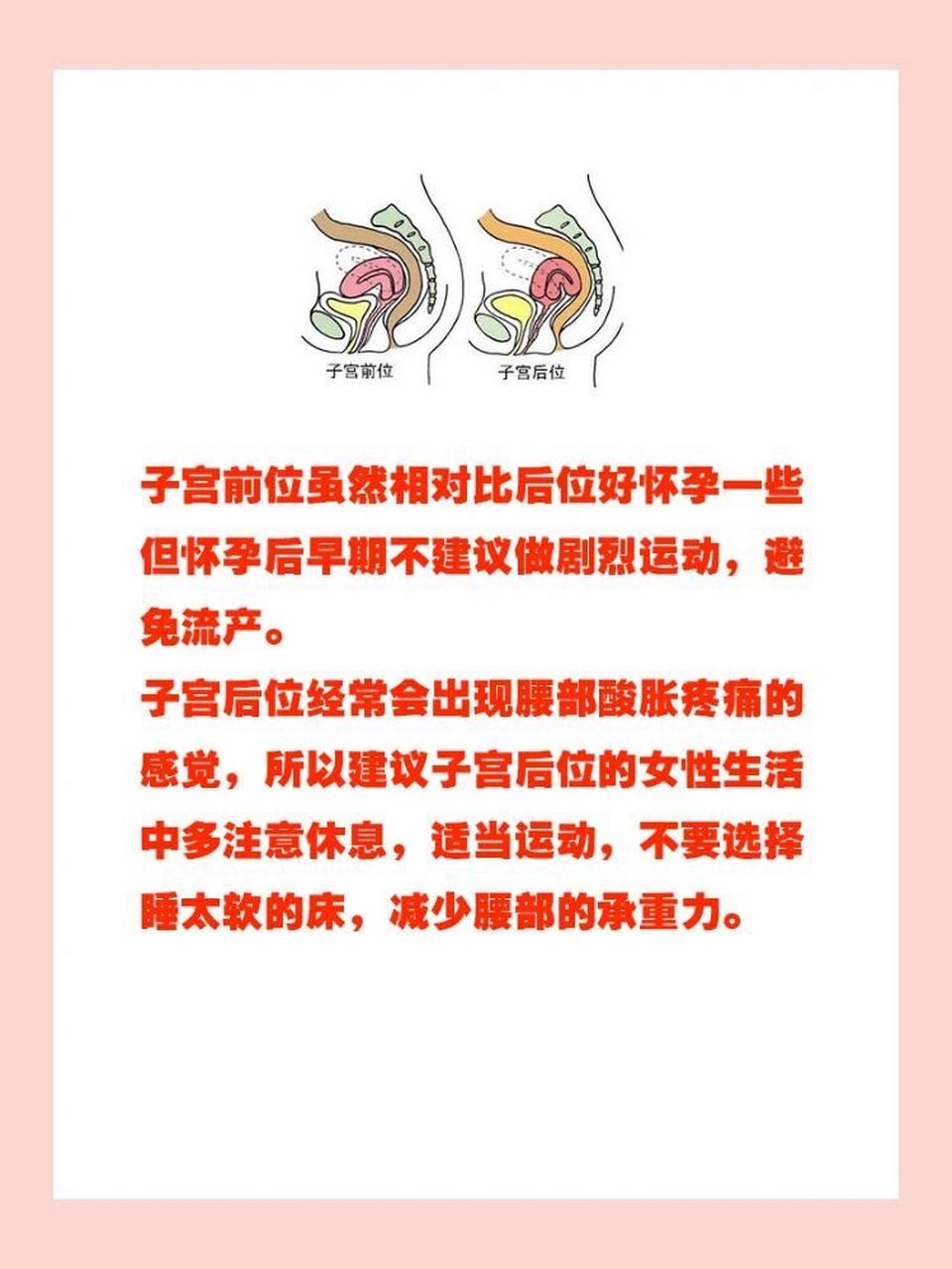 相信很多集美跟我有一样担忧,知道自己子宫后位的时候,担心不好怀孕