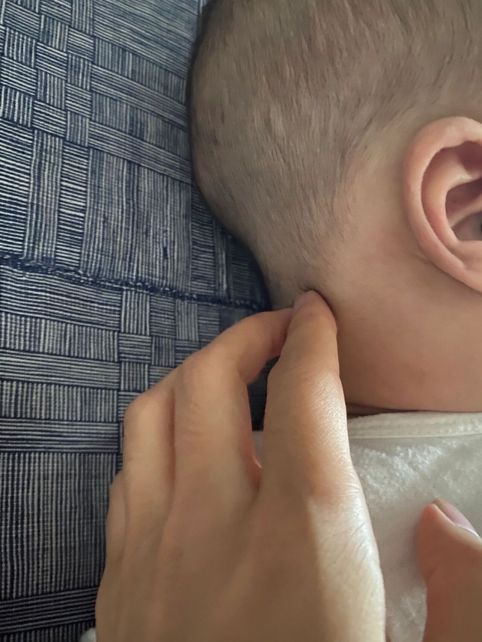 宝宝这个位置 长了个小疙瘩 今天发现后脑勺下边有一个小疙瘩,(原来没