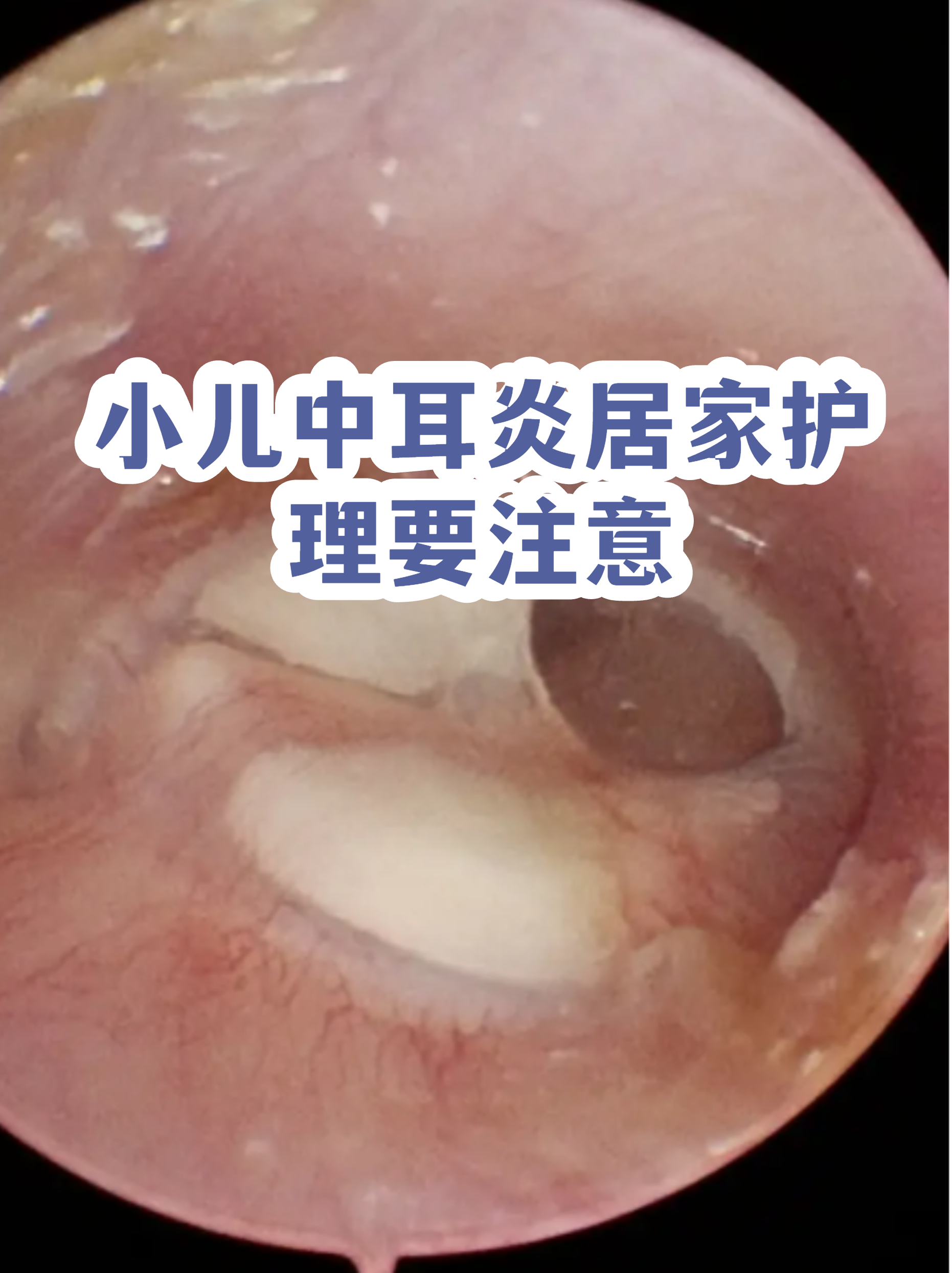 包含地坛医院代诊挂号服务流程出院居家护理提醒，科学恢复身体的词条