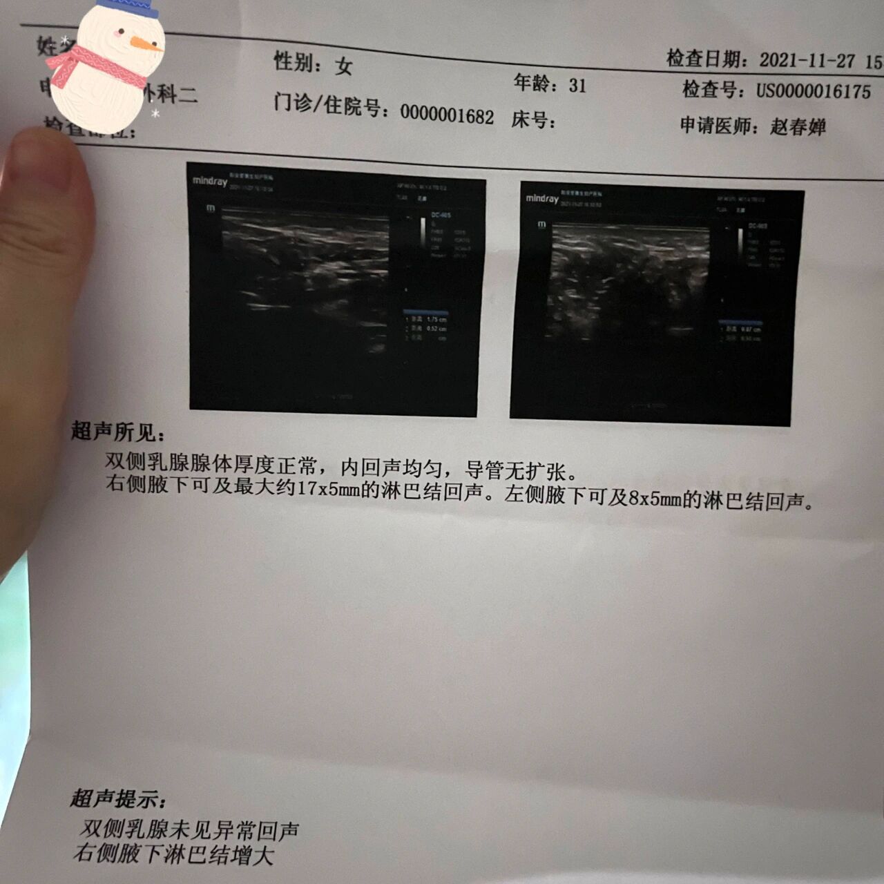 腋下淋巴结 问了好几个医生都说没事,又说不上来为什么肿大,问要治吗!