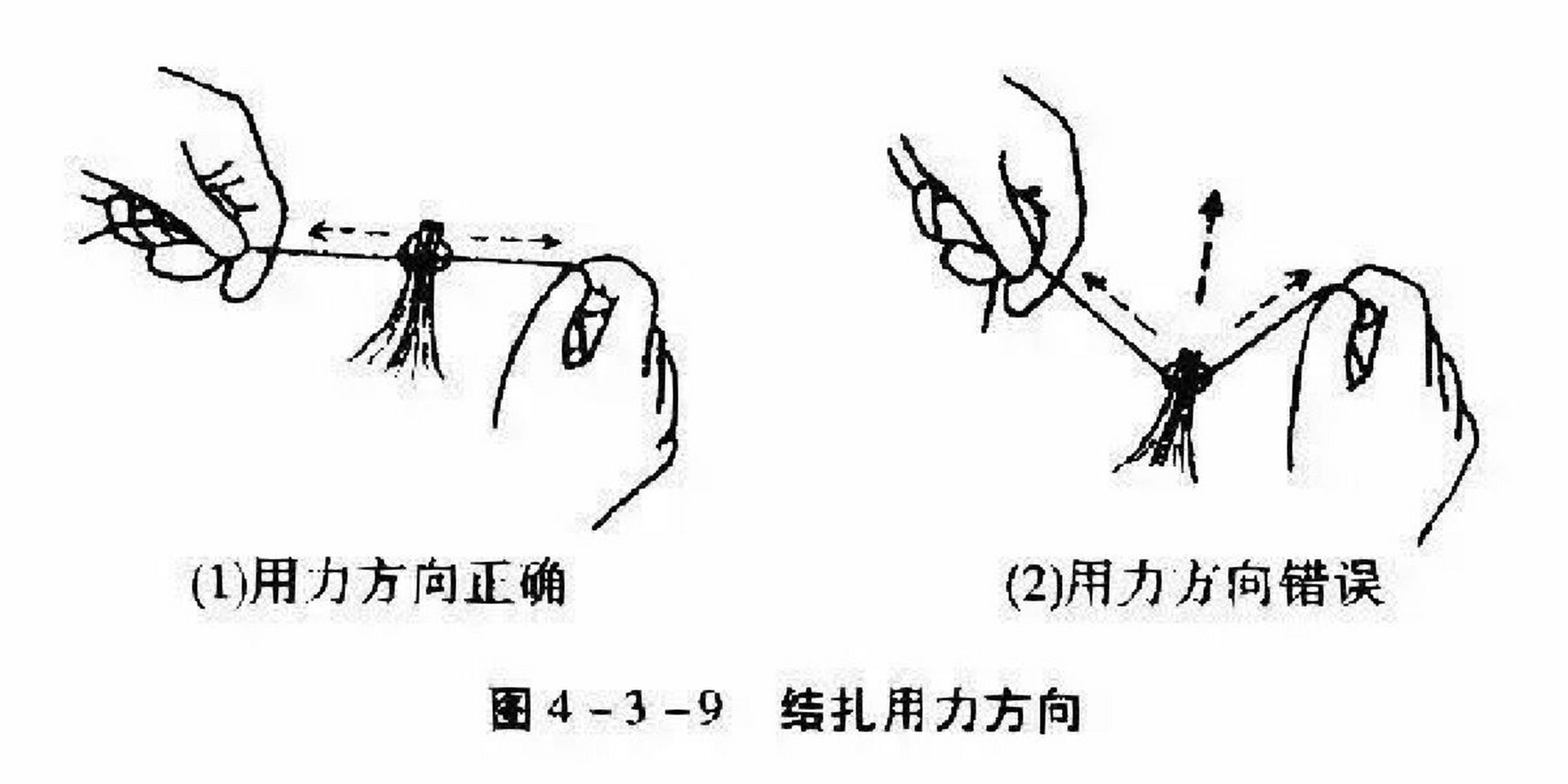 外科打结技能详解(图文并茂)4 注意事项 (1)结扎之前,需将束线在生理