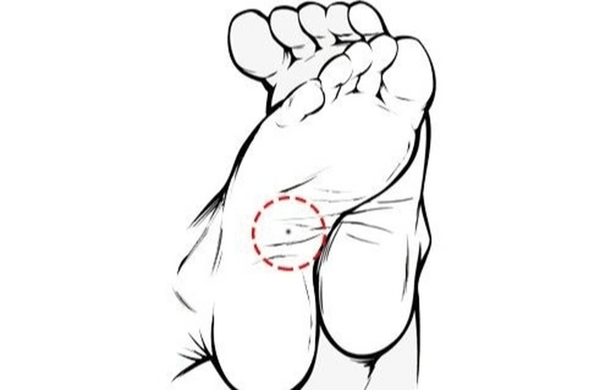 这三个地方有痣,无论男女事业皆易成功 帝一种:脚掌心有痣 相学中脚底