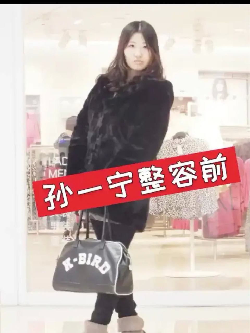 聊一聊孙一宁整容前后做了哪些项目吧 不得不说孙一宁整商还是很高的