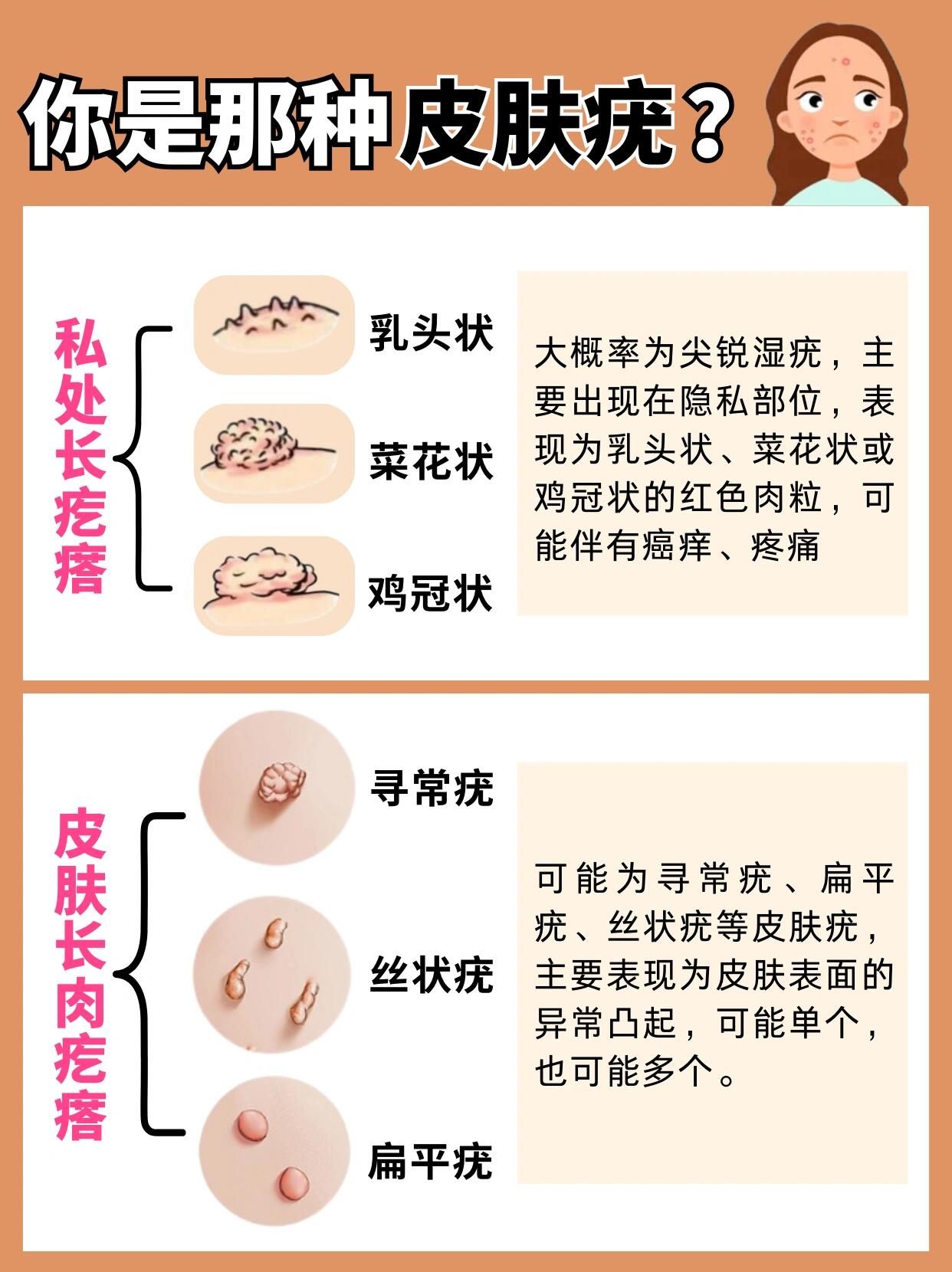 皮肤疣分类型6015三秒自测你是哪种皮肤疣!