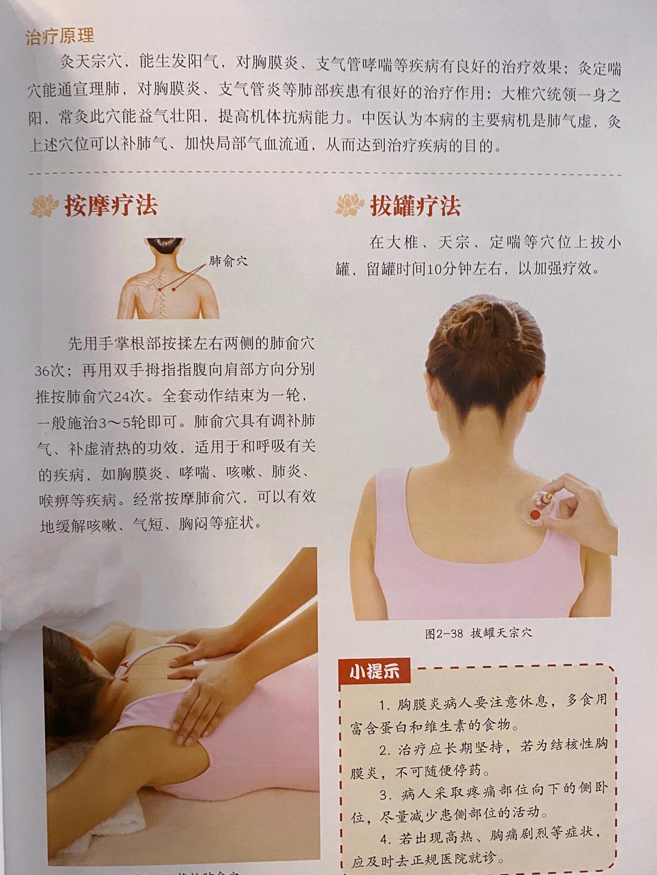 女性乳房拔罐图片