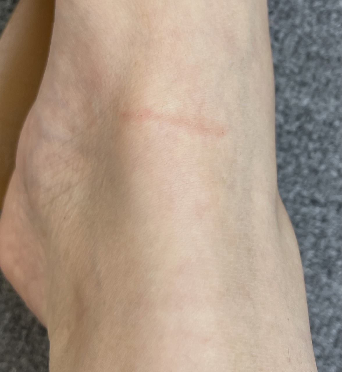 两个月小狗抓一点点破皮要不要打疫苗啊01 捡来的小狗崽子养了一个