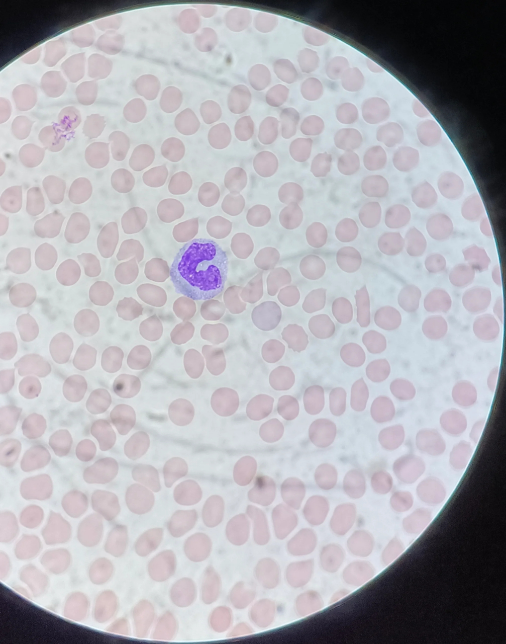 单核细胞 细胞较大,直径14～20um,呈圆形或卵圆形.