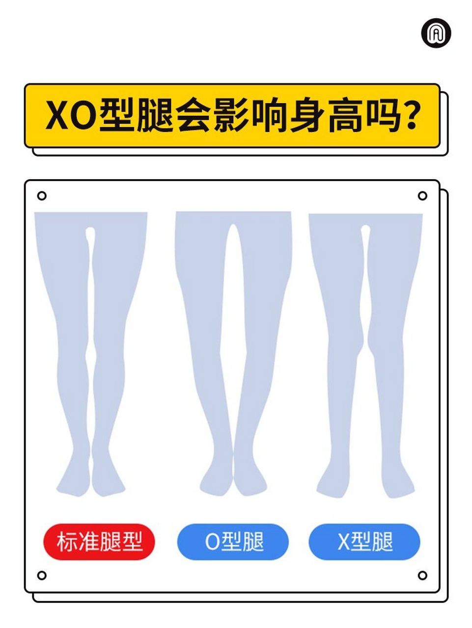 xo型腿绑腿矫正图解图片