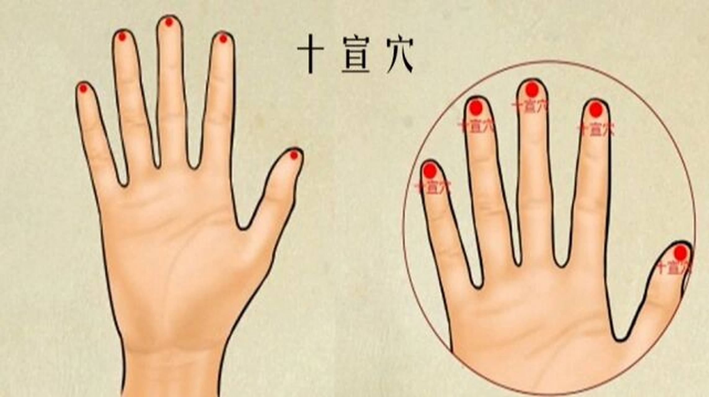 各穴的神经支配:拇指到中指的十宣穴有正中神经分布;无名指的十宣穴有