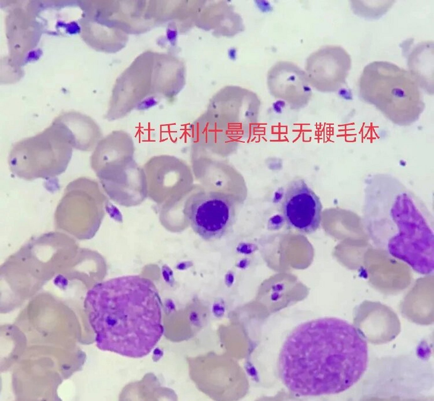 day11杜氏利什曼原虫