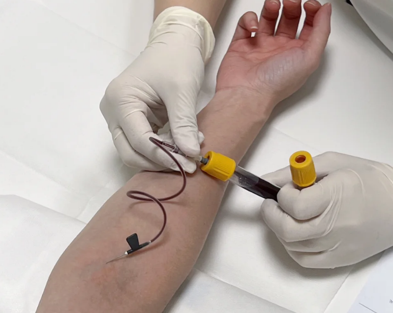 穿刺预约-穿刺预约单上要提供的病理申请单是什么 