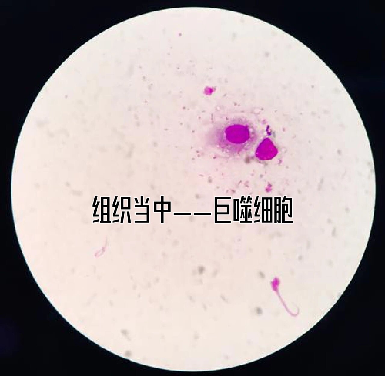 单核细胞和巨噬细胞其实是一类细胞,只是在不同地方有的不同称呼.