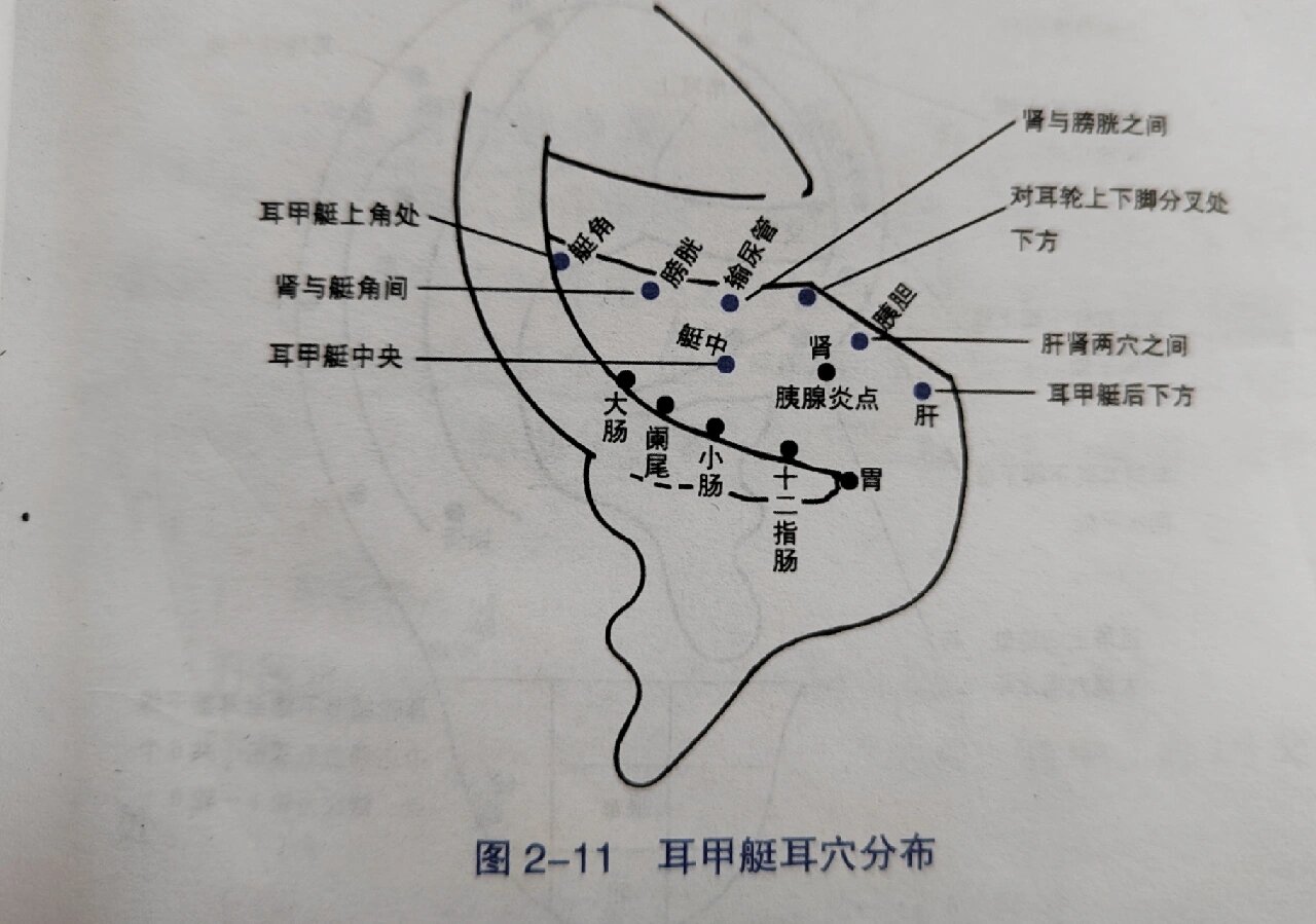 耳甲艇图片