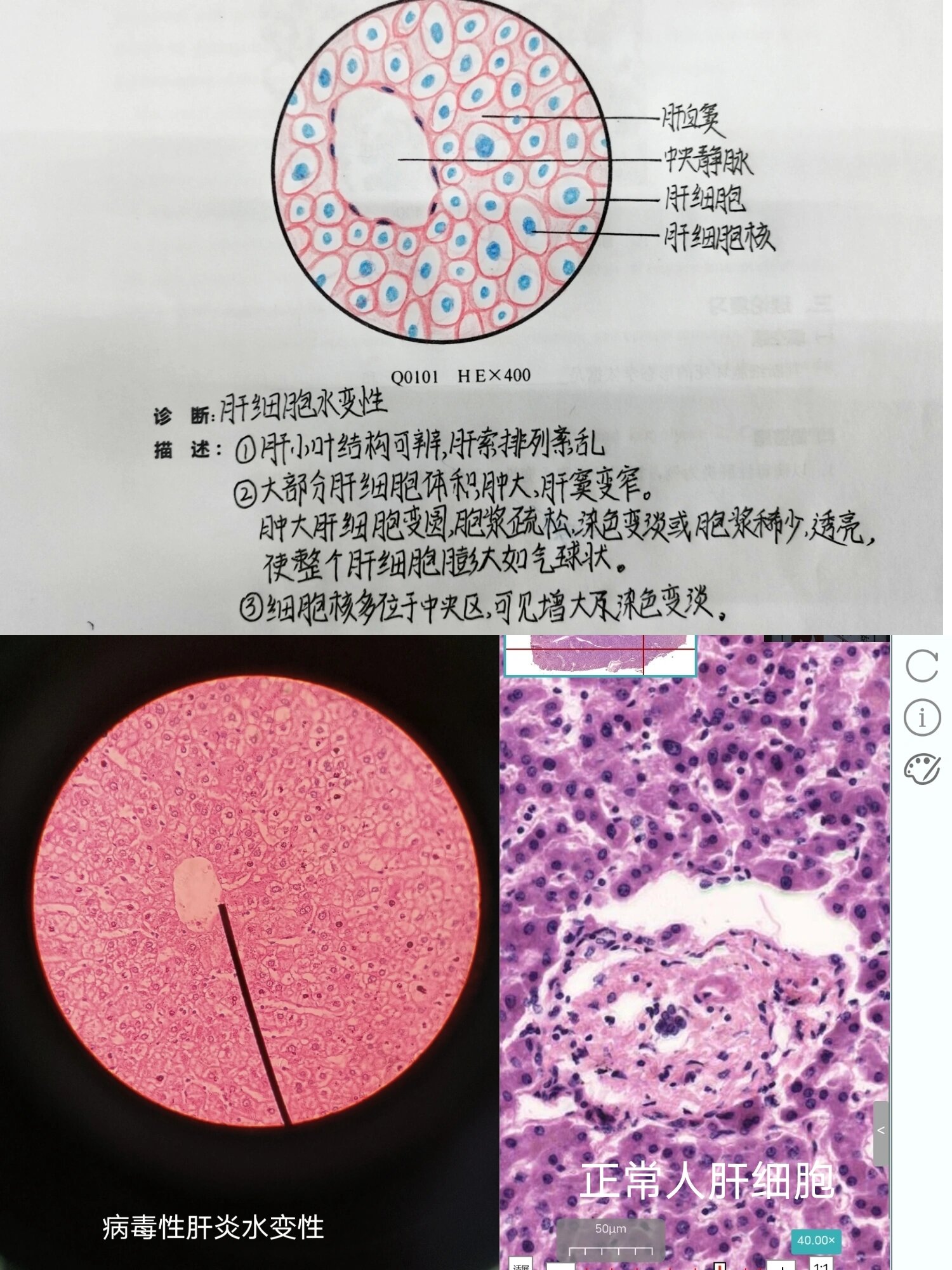 肝小叶红蓝铅笔图片