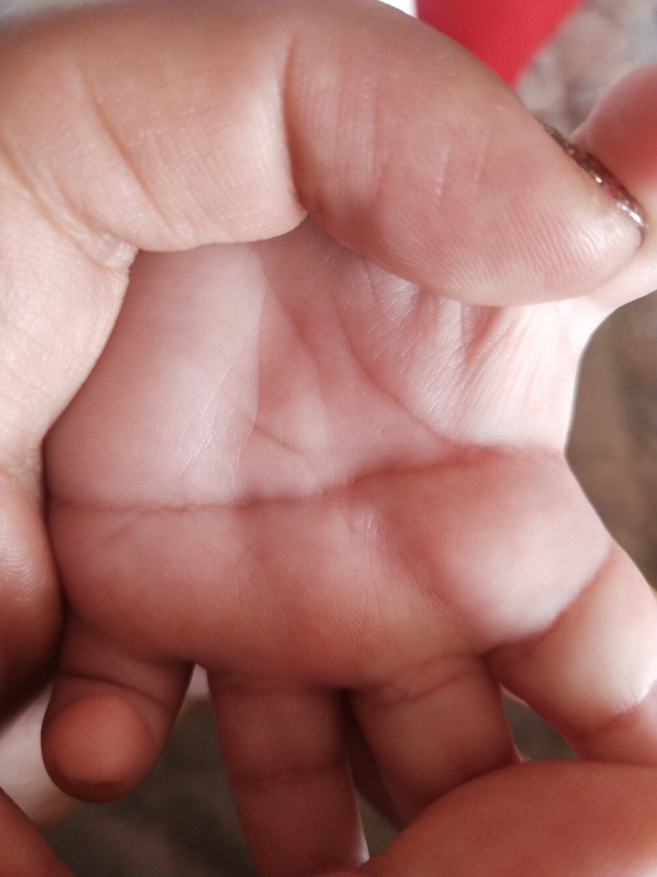 关于宝宝掌纹 我家宝宝双手的都是断掌,都说孩子长大了厉害,我先问问