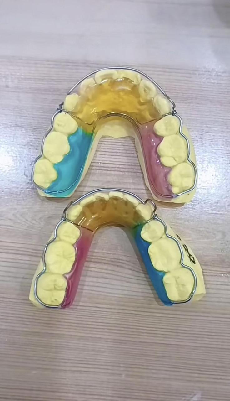 正畸专业分享: 比格保持器(begg)(环绕式保持器),哈雷的 改良ii型.