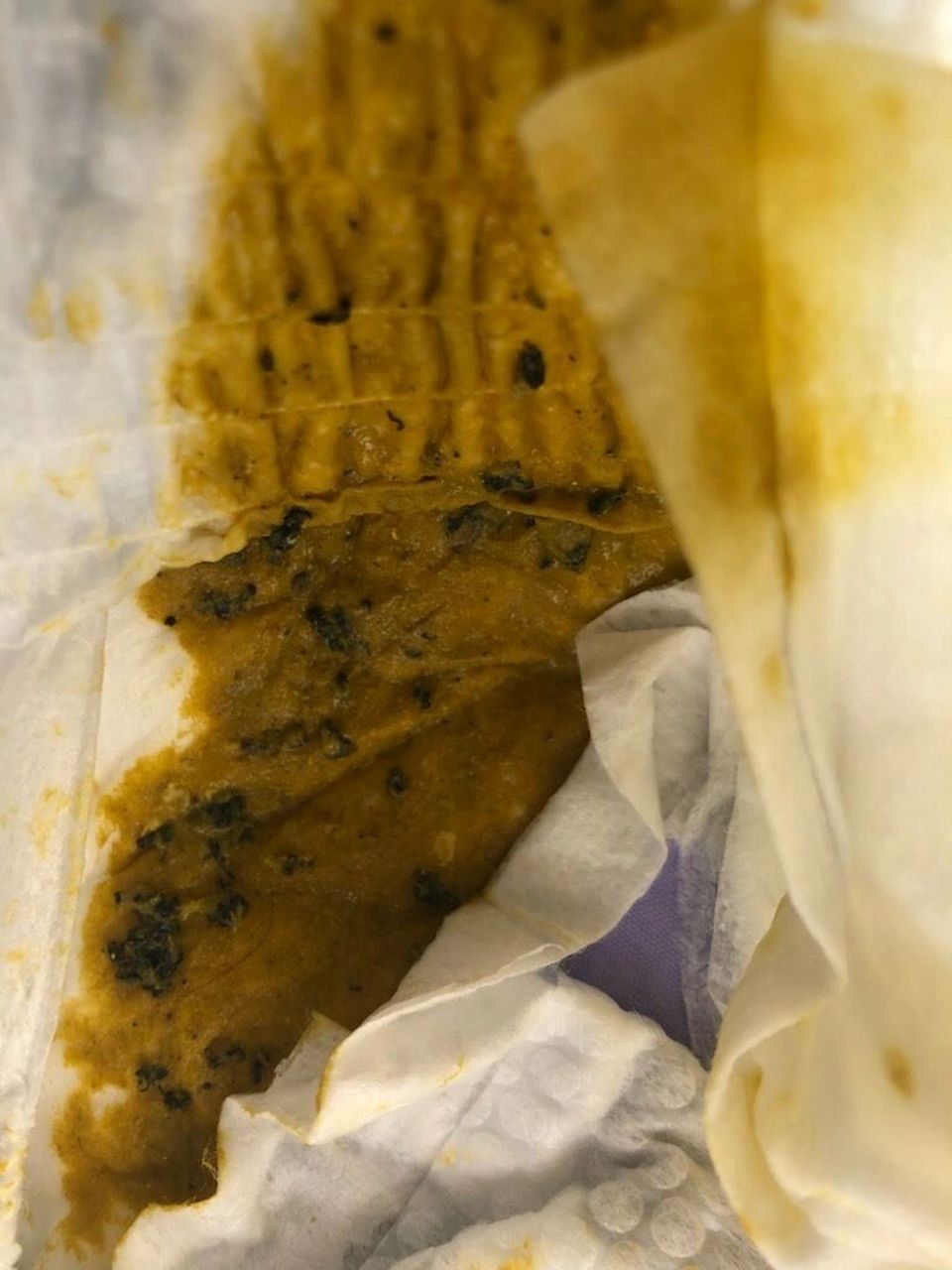 宝宝大便里面的黑点或者黑丝是什么呢?