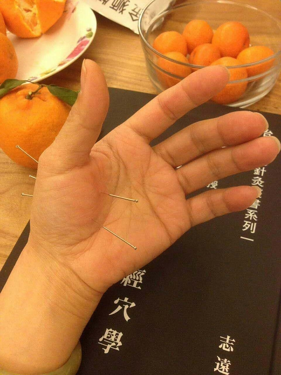 董氏针灸—重子重仙穴 大家好,又到董氏针灸网络课