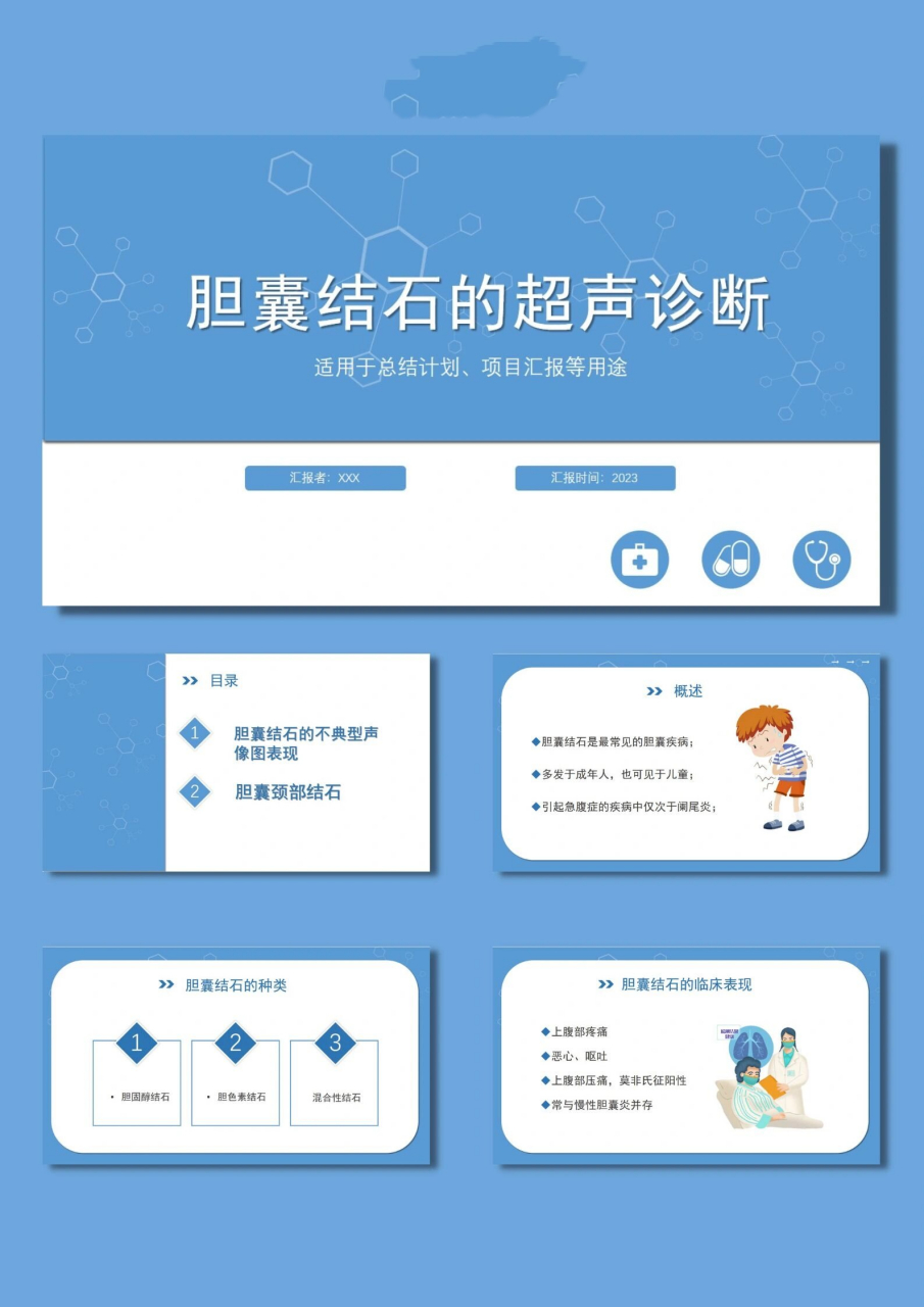 90胆囊结石的超声诊断ppt模板【071】 98页数:25(图片文字均可