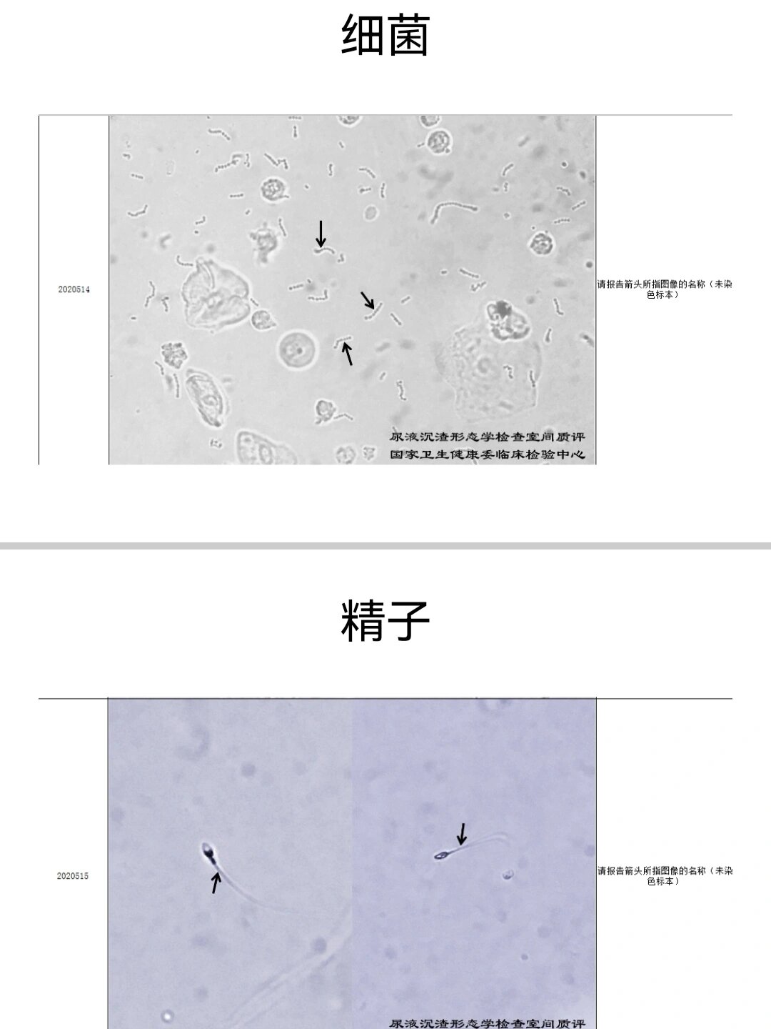 尿沉渣形态学检查1