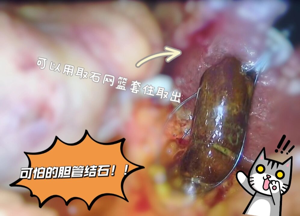 不开刀就能做的手术