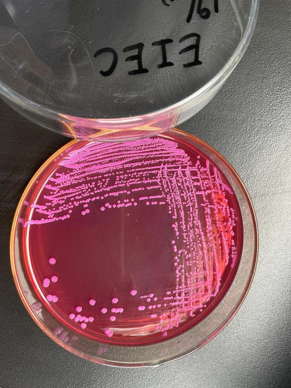 五种致泻性大肠杆菌在ss平板上的菌落形态