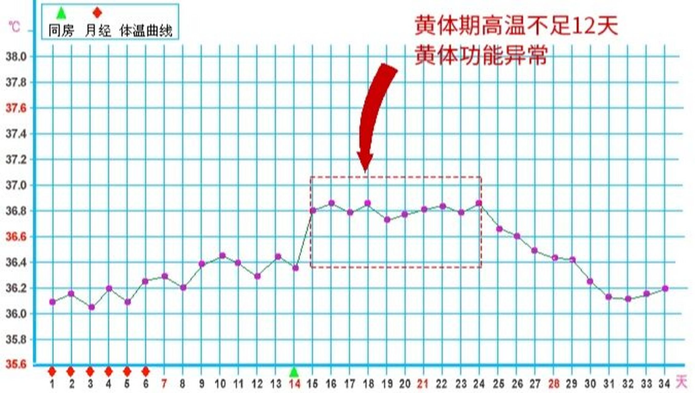 黄体不足的基础体温图图片