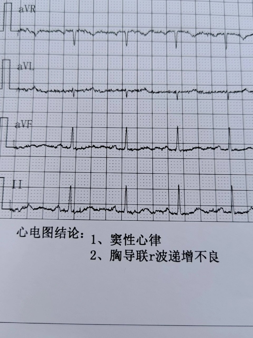 因为心电图被拒入职图片