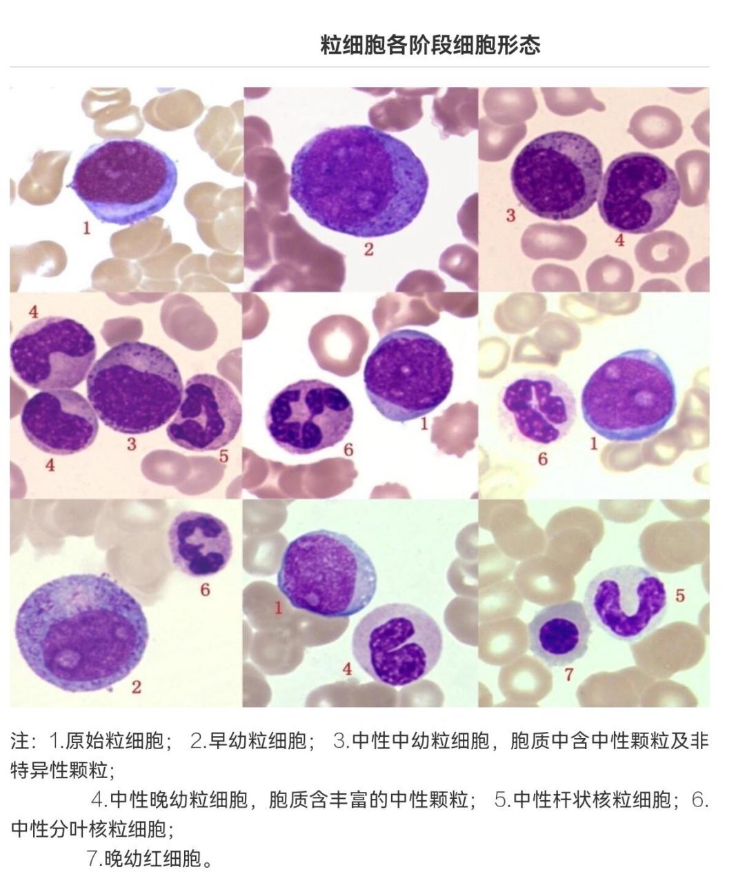 中性杆状核粒细胞形态图片