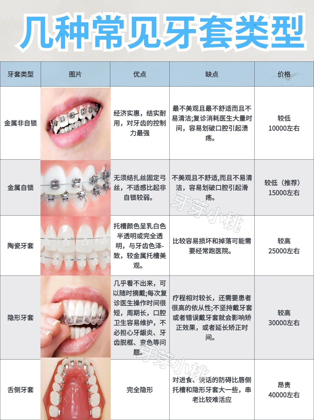 几种常见牙套类型