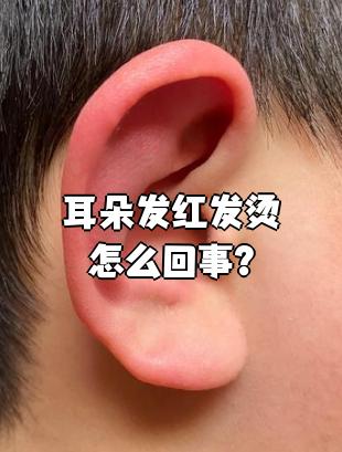 耳朵发红发烫可能和感染,过敏,运动或温差变化有关