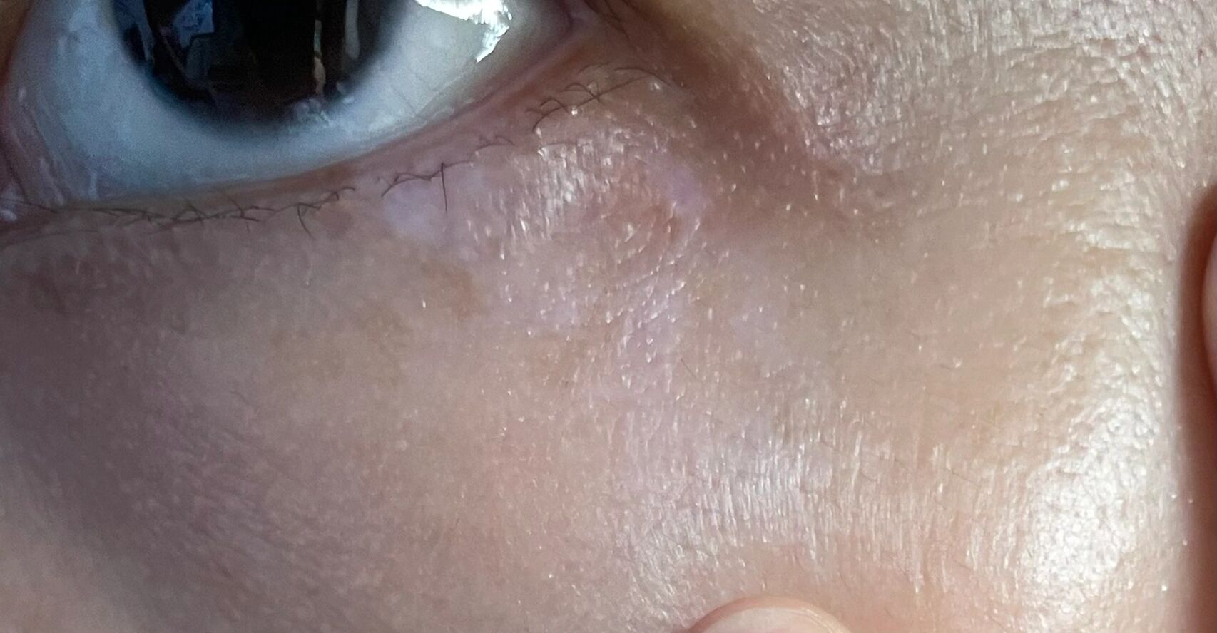 左边外眼角有几个白斑(好像很久了,几年了吧),仔细看才能看清,上眼线