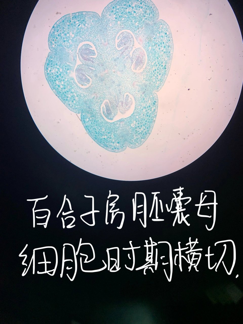 百合子房二分体期切片 5.百合胚珠胚囊内四核期 6.