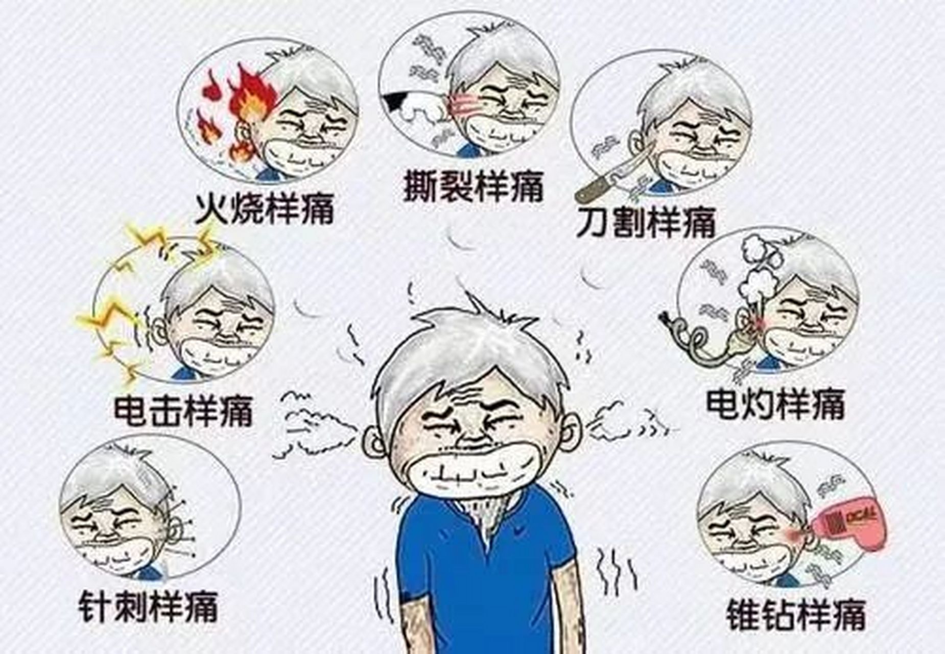 三叉神经痛主要是局限于三叉神经分布区的疼痛,以上颌支和下颌支都